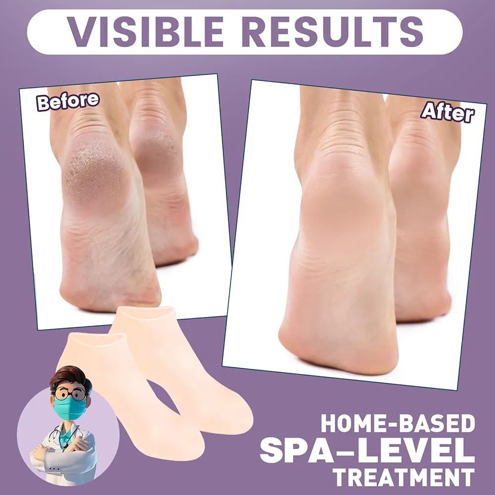 1 Pair Full Silicone Gel Heel Socks – Moisturizing & Anti-Crack Foot Care