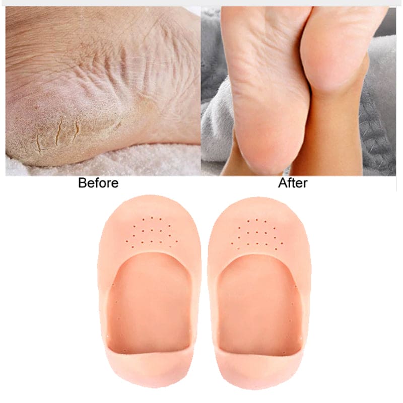 1 Pair Full Silicone Gel Heel Socks – Moisturizing & Anti-Crack Foot Care